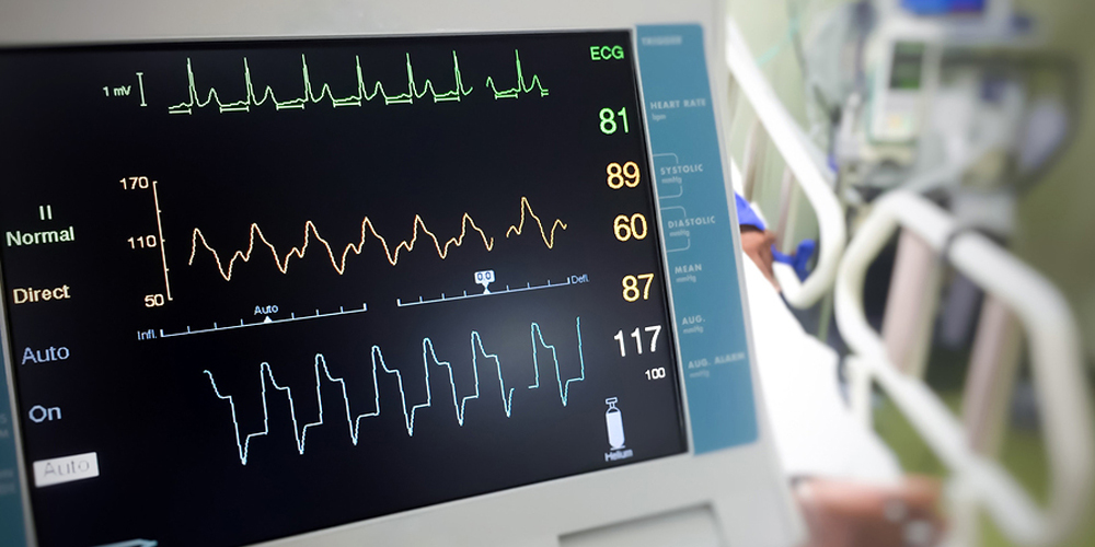 Doppler echocardiogram
